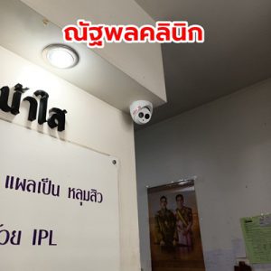 กล้องวงจรปิดขอนแก่น CCTV ราคาถูก